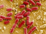 Loại siêu vi khuẩn mới có khả năng chống lại loại thuốc kháng sinh mạnh nhất. Ảnh: Independent.