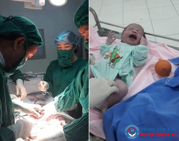 Trung tâm Y tế huyện Thạch Hà: Phẫu thuật kịp thời sản phụ bị sa dây rốn, cứu sống thai nhi